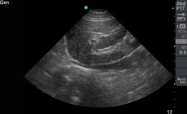 Video Gallery Emergency Medicine News