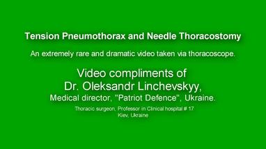 Video Gallery Emergency Medicine News