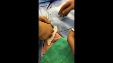 video gallery plastic and reconstructive surgery global open