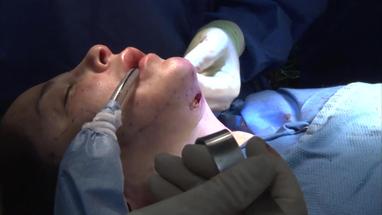 Video Gallery Plastic And Reconstructive Surgery