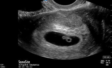 Video Gallery Emergency Medicine News