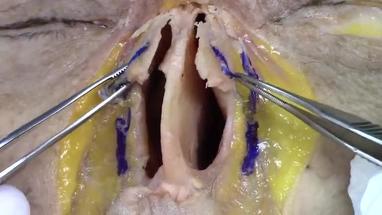 Video Gallery Plastic And Reconstructive Surgery