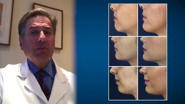 Video Gallery Plastic And Reconstructive Surgery