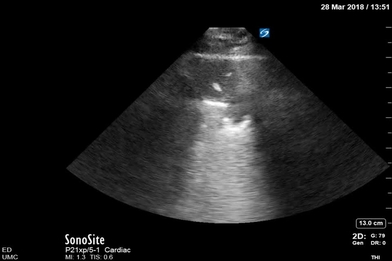 Video Gallery Emergency Medicine News