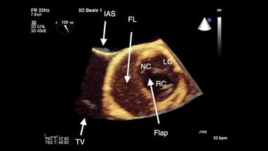 Video Gallery Anesthesia Analgesia