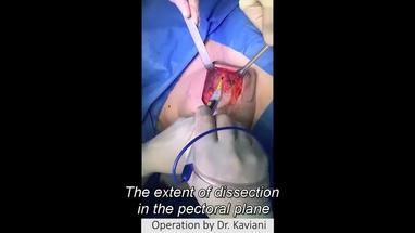 Surgical Wound Dressing Procedure Video Video Gallery Plastic And Reconstructive Surgery Global Open