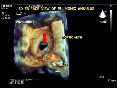 Video Gallery Anesthesia Analgesia