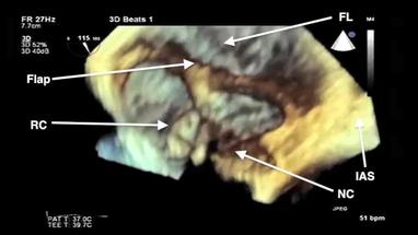 Video Gallery Anesthesia Analgesia