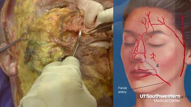 Video Gallery Plastic And Reconstructive Surgery Global Open