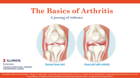 Thumbnail for entry Presentation_Inflammation and Arthritis: The Basics of Arthritis