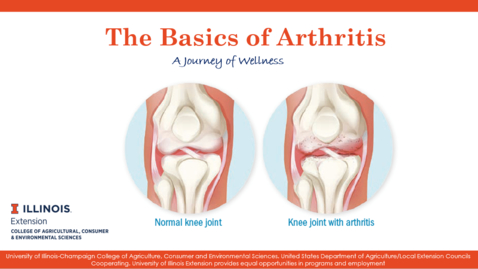 Thumbnail for Presentation_Inflammation and Arthritis: The Basics of Arthritis