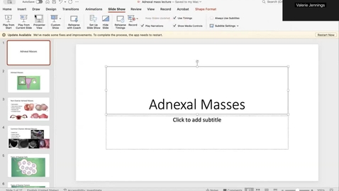 Thumbnail for Adnexal Mass Lecture