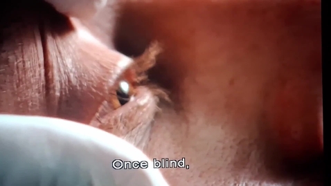 Thumbnail for Regaining Vision after long blindness (AD).mp4