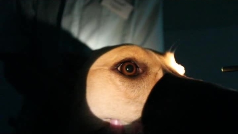 Thumbnail for Ophthalmic exam techniques: Indirect pupillary light reflex with lights off