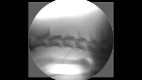Thumbnail for Upper GI Imaging: Clip 6