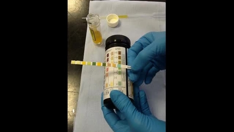 Thumbnail for entry Urinalysis: Urine dipstick, refractometer reading of specific gravity and urine sediment examination