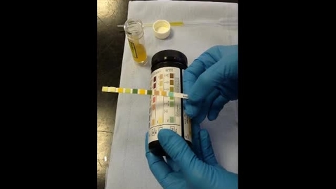 Thumbnail for Urinalysis: Urine dipstick, refractometer reading of specific gravity and urine sediment examination