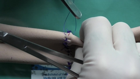 Thumbnail for Steps to perform an end to end bowel anastomosis using an interrupted suture