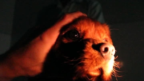Thumbnail for Ophthalmic exam techniques: Direct pupillary light reflex