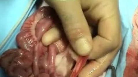 Thumbnail for Performing an exploratory coeliotomy in the cat