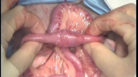 Thumbnail for entry Removing a foreign body from the jejunum in the dog