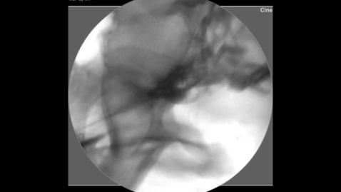 Thumbnail for Fluoroscopy of the swallowing dog