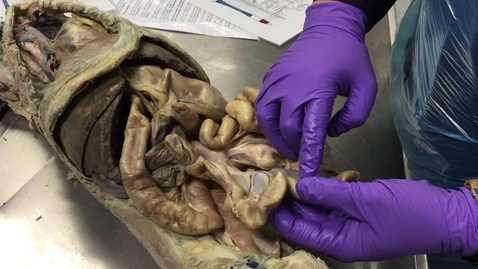 Thumbnail for Anatomy of the gastrointestinal tract in the dog: Ileum