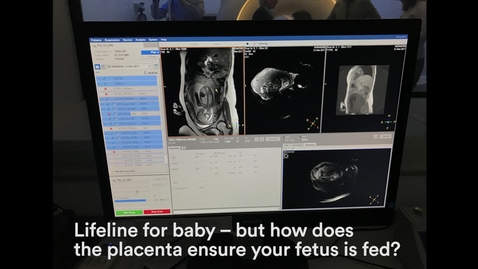 Thumbnail for Lifeline for baby – but how does the placenta ensure your fetus is fed?