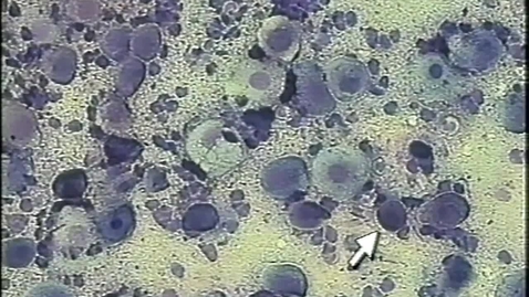 Thumbnail for entry Vaginal cytology in the dog