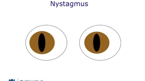Thumbnail for Nystagmus