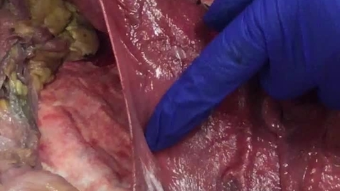 Thumbnail for Reproductive tract in the mare: Clip 1