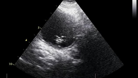 Thumbnail for Bladder imaging