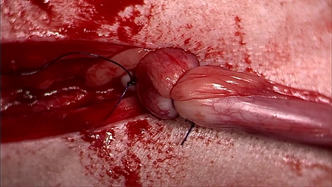 Thumbnail for entry Ovariohysterectomy in the bitch: Ligation of the cervix