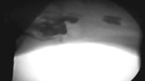 Thumbnail for Upper GI imaging: Clip 1