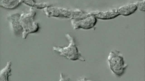 Thumbnail for Cell biology: Chemotaxis