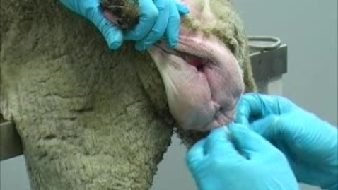 Thumbnail for Using the Bühner method to treat vaginal prolapse