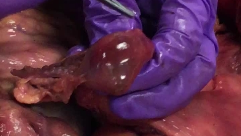 Thumbnail for Ovaries in the cow