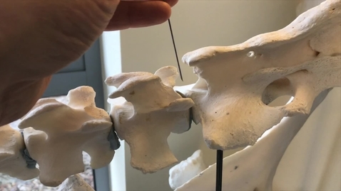 Thumbnail for entry Cow epidural anatomy