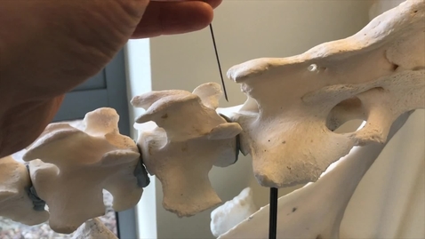 Thumbnail for Cow epidural anatomy