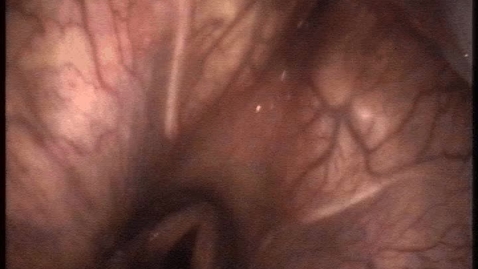 Thumbnail for URT endoscopy in the static horse