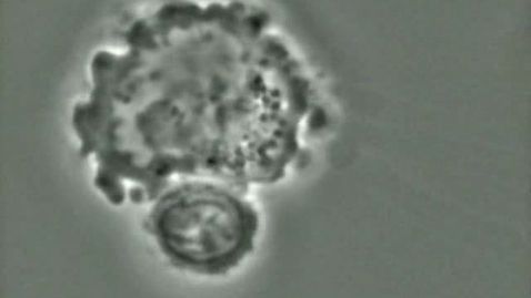 Thumbnail for Cell biology: Cytotoxic T-Lymphocyte