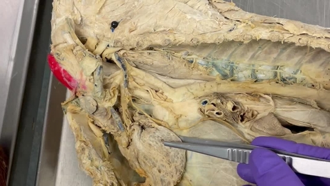 Thumbnail for Thymus in the dog thorax