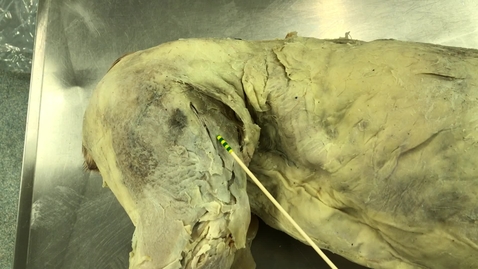 Thumbnail for Hindlimb muscles of the dog: Quadriceps femoris