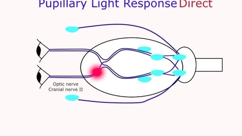 Thumbnail for entry Pupillary light response pathways