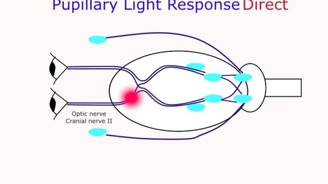 Thumbnail for Pupillary light response pathways
