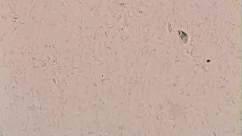 Thumbnail for Semen motility: Clip 3