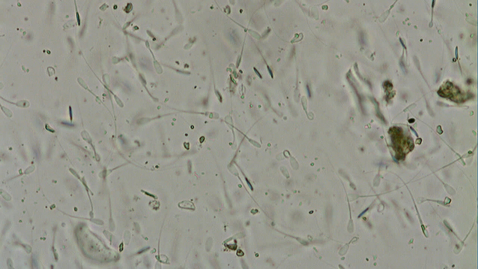 Thumbnail for Semen motility: Clip 1