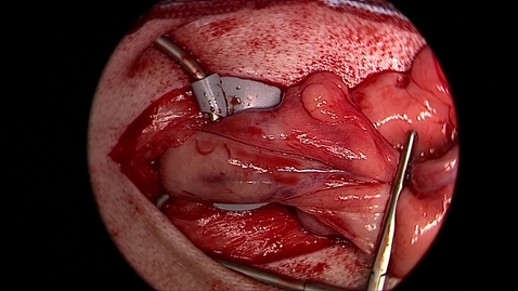 Thumbnail for Ovariohysterectomy in the bitch: Use of a Dowling retractor