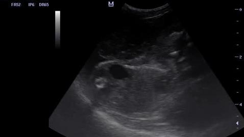 Thumbnail for Ultrasound of the pregnant rabbit