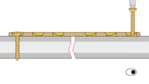Thumbnail for Placing a dynamic compression plate for fixation of bone